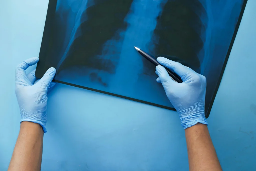 Legal compensation concept with injured spine illustration and law documents.