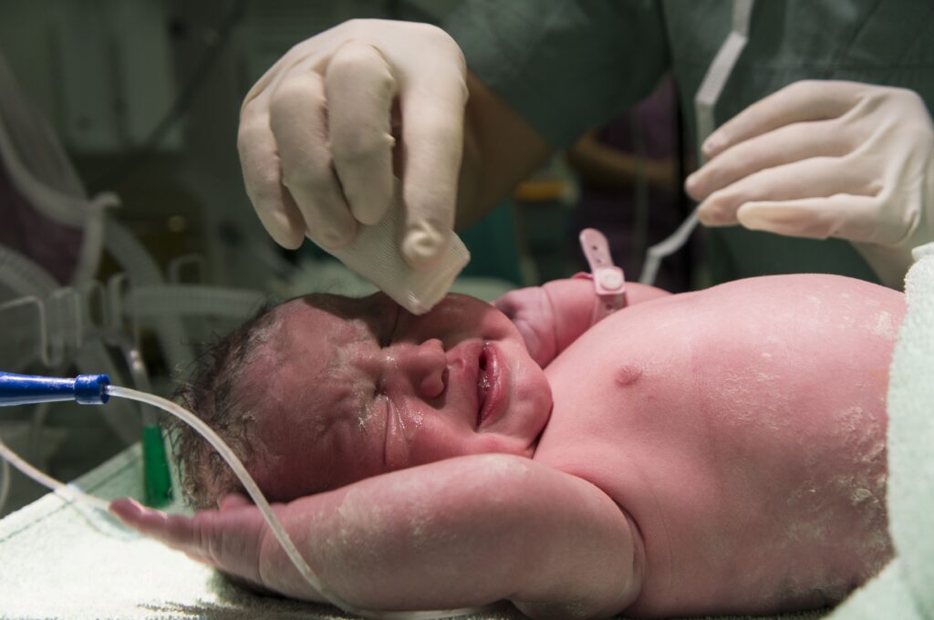 Child affected by birth injuries from assisted deliveries with parents looking concerned